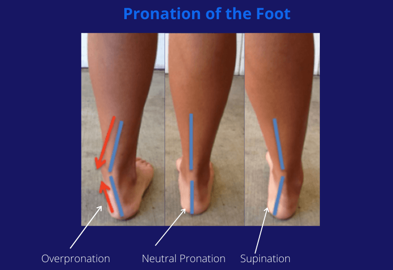 Pronation of the foot